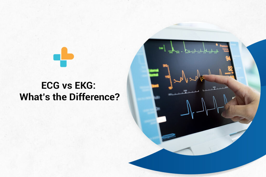 EKG vs EKG: koks skirtumas?