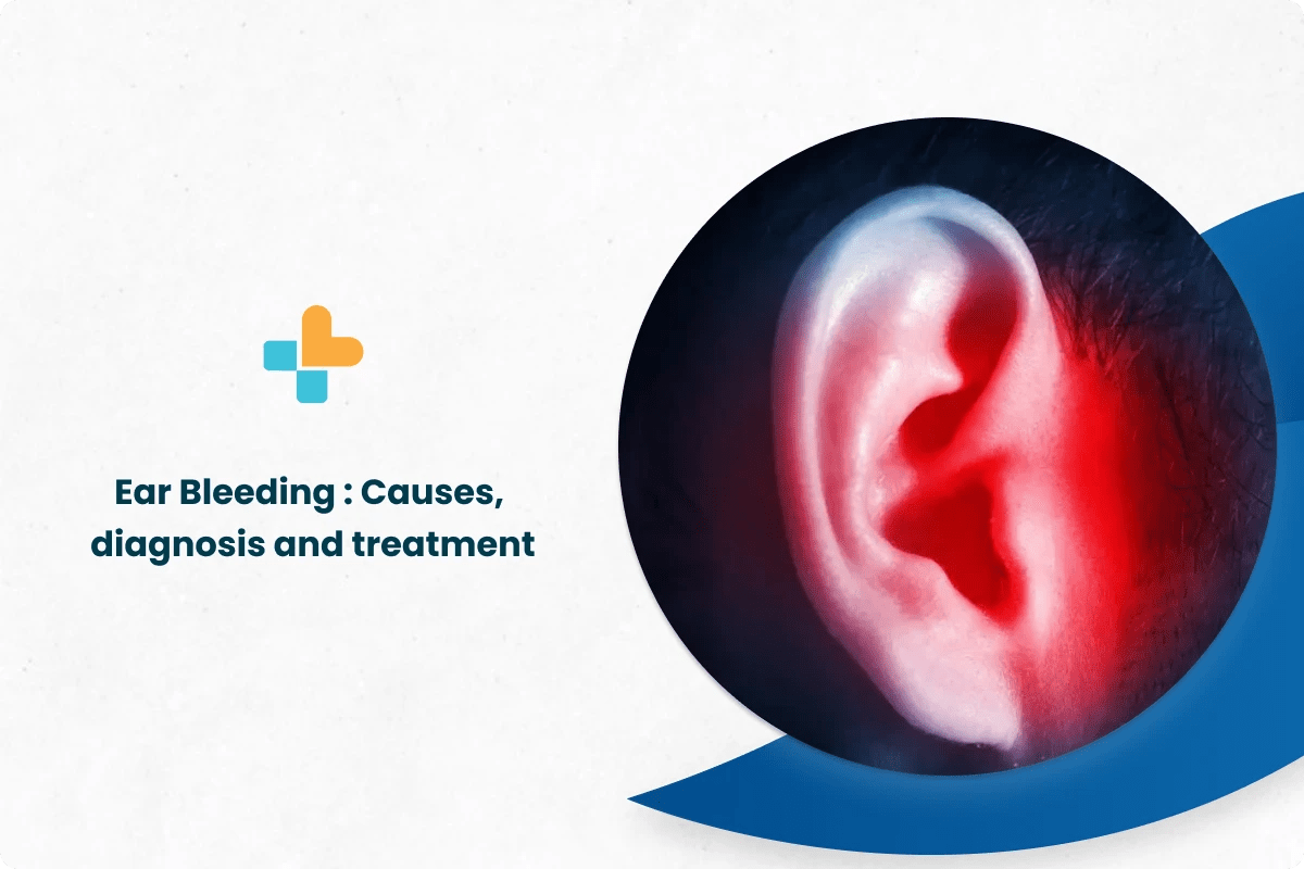 Kraujavimas iš ausies: priežastys, diagnozė ir gydymas